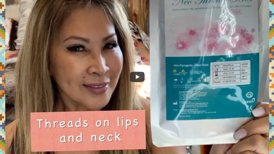More treatment of threads on my lips and neck #PDOthreads#agingskin#Glamderma